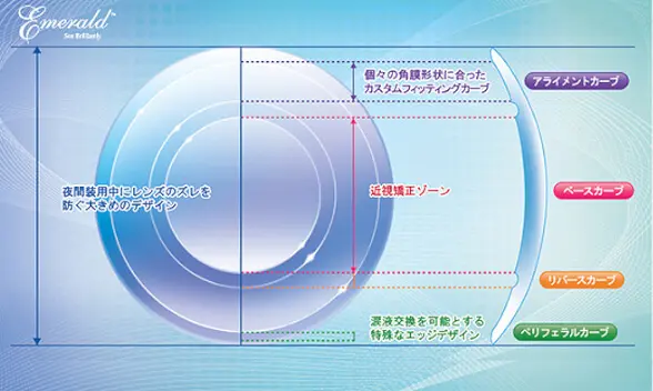 オルソケラトロジー【費用と特徴】